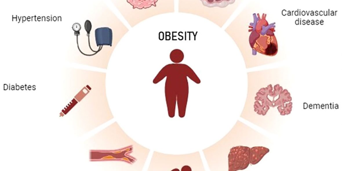 fendo-15-1349794-g001